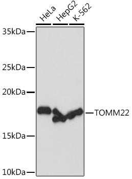TOMM22 Rabbit mAb