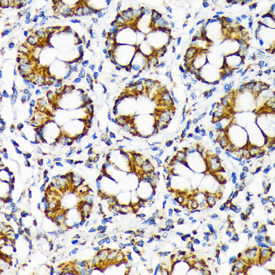TOMM22 Rabbit mAb