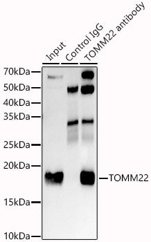 TOMM22 Rabbit mAb
