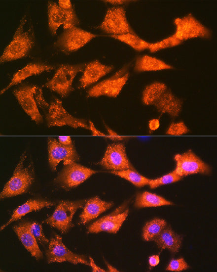 GSTK1 Rabbit mAb