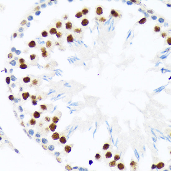 PIAS1+PIAS2 Rabbit mAb