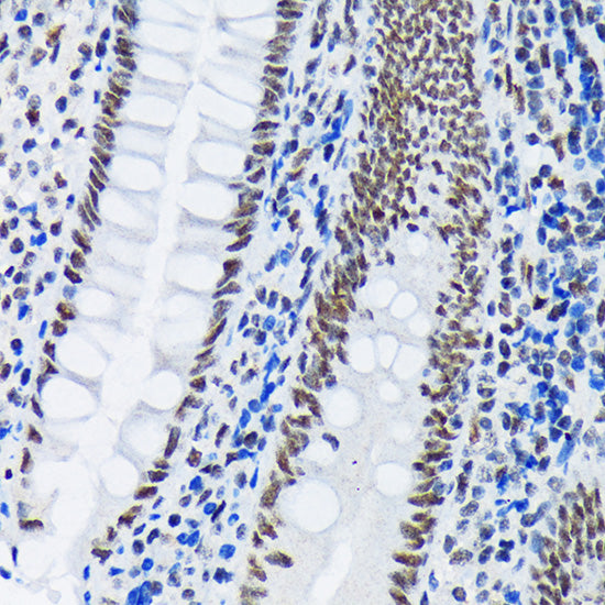 PIAS1+PIAS2 Rabbit mAb