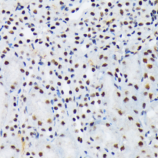 PIAS1+PIAS2 Rabbit mAb