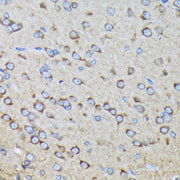 RALBP1 Rabbit mAb