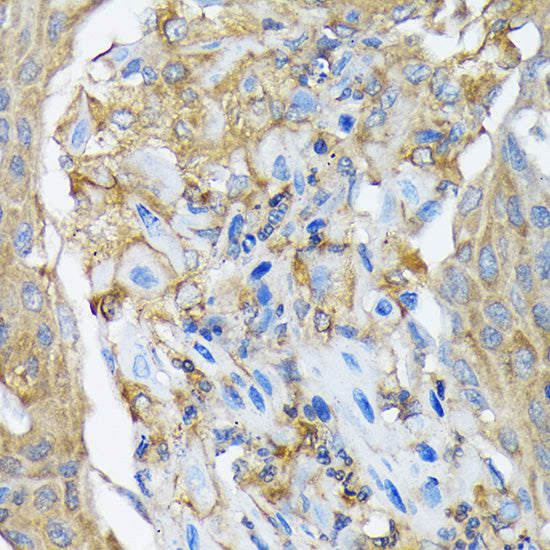 RALBP1 Rabbit mAb