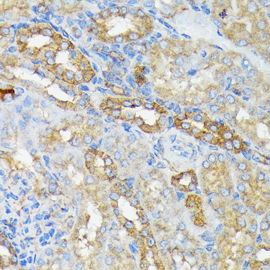 RALBP1 Rabbit mAb