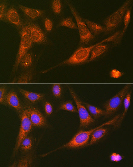 RALBP1 Rabbit mAb