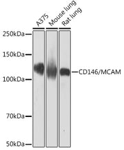 CD146/MCAM Rabbit mAb