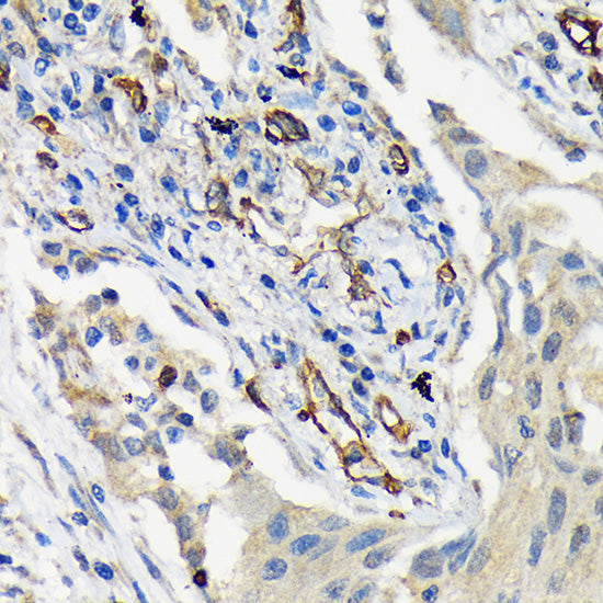 CD146/MCAM Rabbit mAb