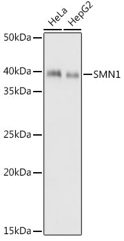 SMN1 Rabbit mAb