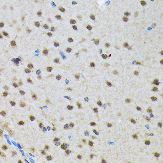 SMN1 Rabbit mAb