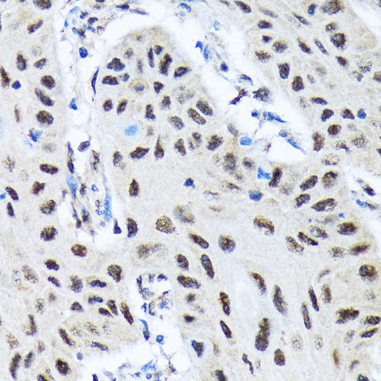 SMN1 Rabbit mAb