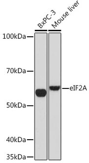 eIF2A Rabbit mAb
