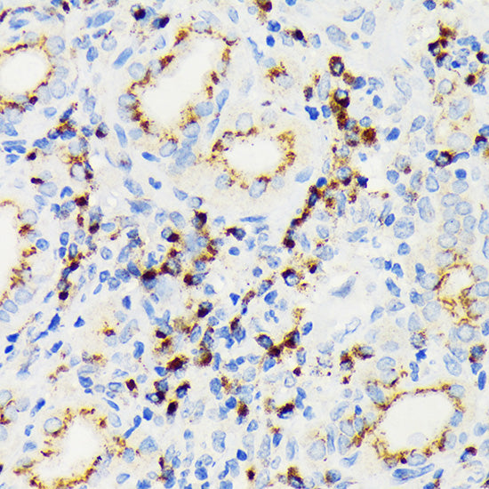 eIF2A Rabbit mAb