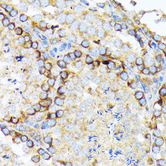 eIF2A Rabbit mAb