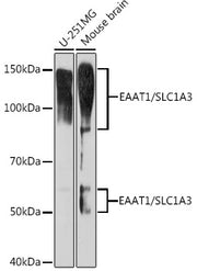 EAAT1/SLC1A3 Rabbit mAb