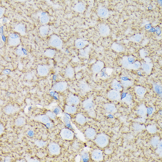EAAT1/SLC1A3 Rabbit mAb