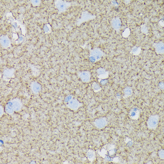 EAAT1/SLC1A3 Rabbit mAb