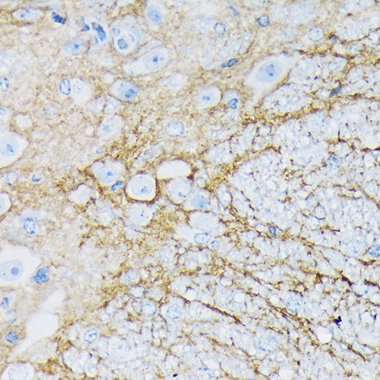 EAAT1/SLC1A3 Rabbit mAb