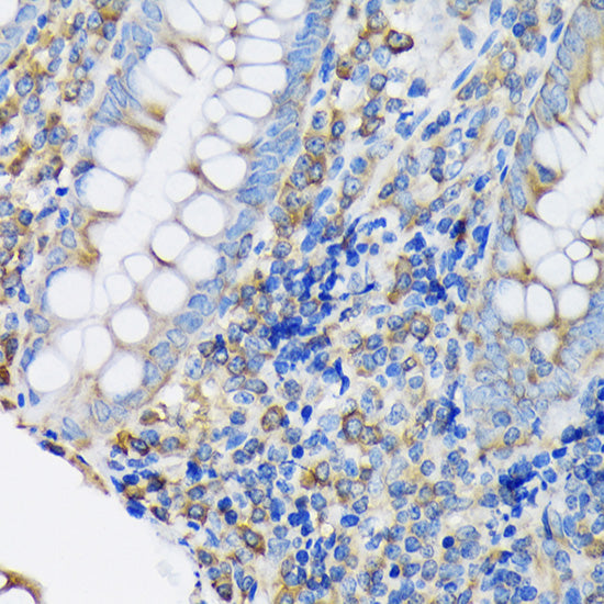 eEF2 Rabbit mAb