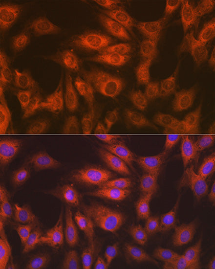 eEF2 Rabbit mAb