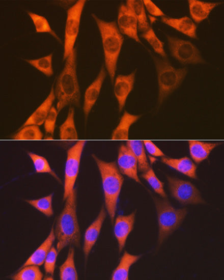 eEF2 Rabbit mAb