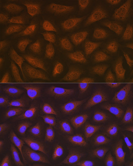 eEF2 Rabbit mAb