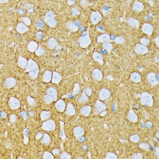 GRIK2 Rabbit mAb