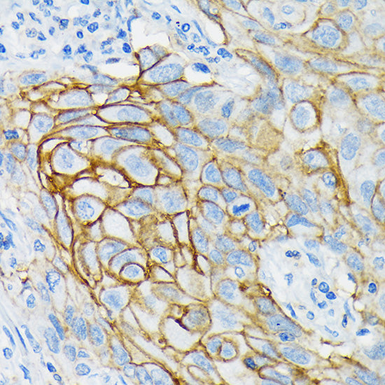 GRIK2 Rabbit mAb