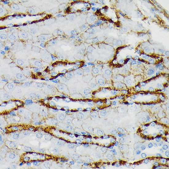 GRIK2 Rabbit mAb