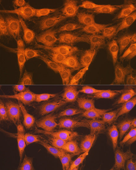 RAP1A + RAP1B Rabbit mAb