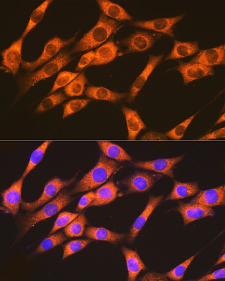 RAP1A + RAP1B Rabbit mAb