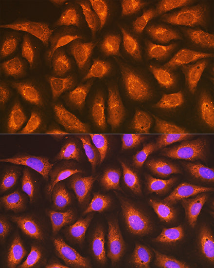RAP1A + RAP1B Rabbit mAb