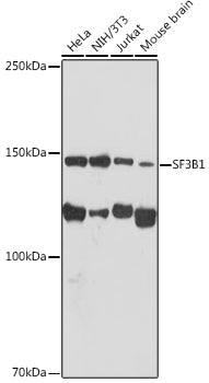 SF3B1 Rabbit mAb