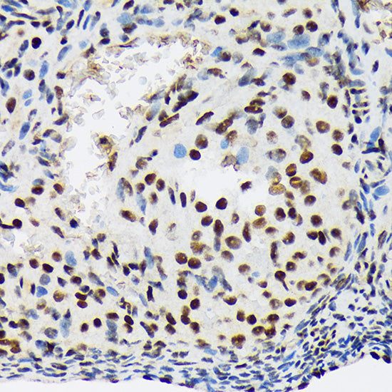SF3B1 Rabbit mAb