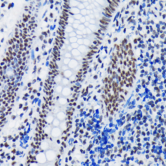 SF3B1 Rabbit mAb