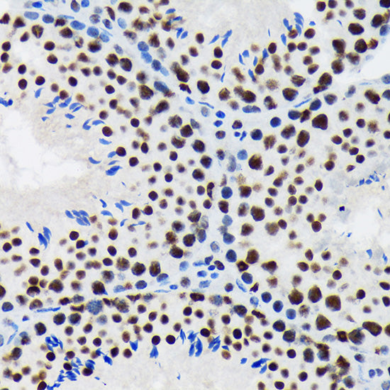 SF3B1 Rabbit mAb