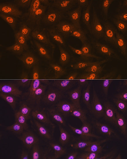 SF3B1 Rabbit mAb