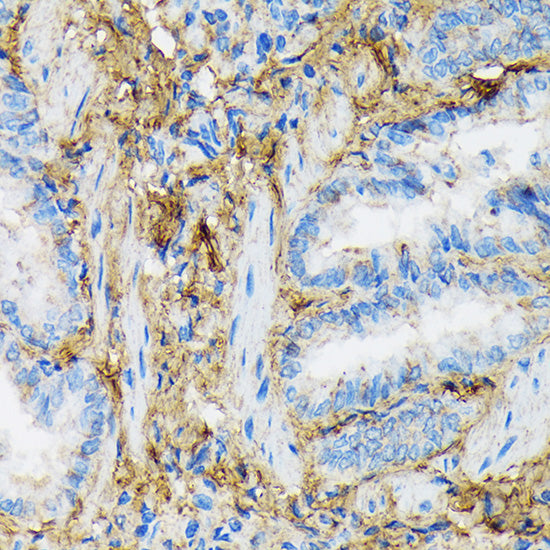Collagen VI/COL6A1 Rabbit mAb