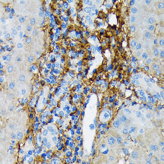 Collagen VI/COL6A1 Rabbit mAb