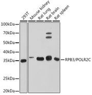 RPB3/POLR2C Rabbit mAb