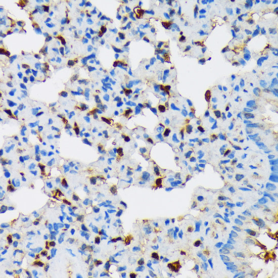 RPB3/POLR2C Rabbit mAb