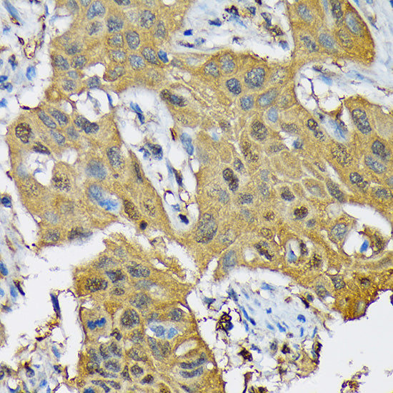 RPB3/POLR2C Rabbit mAb