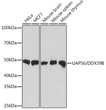 UAP56/DDX39B Rabbit mAb