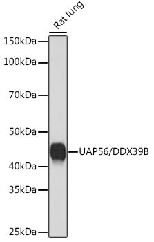UAP56/DDX39B Rabbit mAb