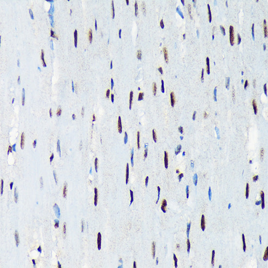 UAP56/DDX39B Rabbit mAb