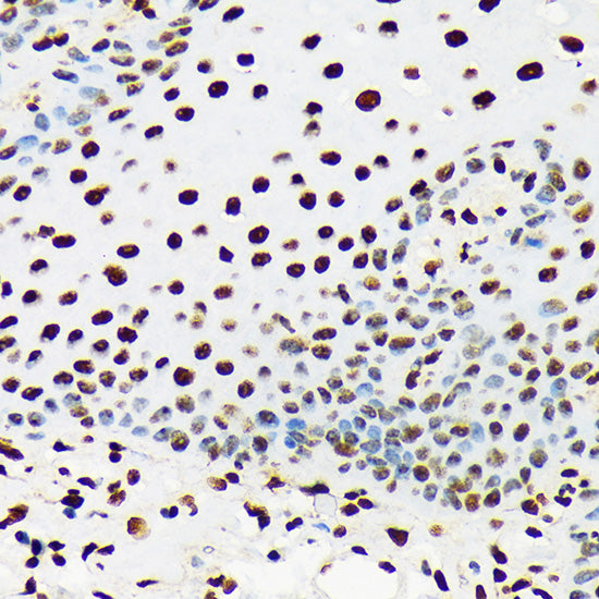UAP56/DDX39B Rabbit mAb