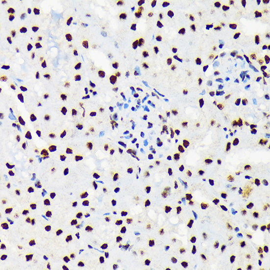 UAP56/DDX39B Rabbit mAb
