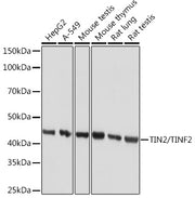 TIN2/TINF2 Rabbit mAb