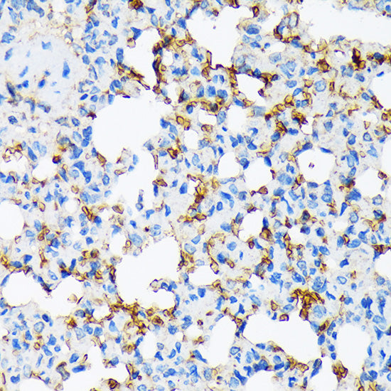 Alpha-2-Macroglobulin (A2M) Rabbit mAb
